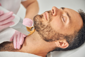Man verwijdering baard